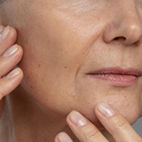 signs-of-skin-aging